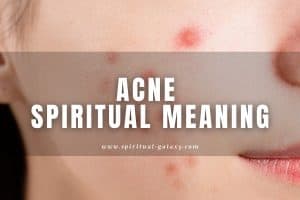 Acne spiritual meaning: How does it affect your health?